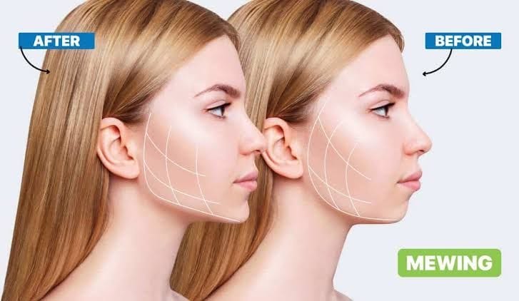 Mewing Meaning, Definition, Benefits, and Complete Internet Trend Guide mewing face